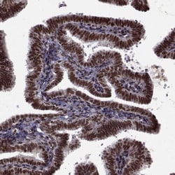 LAD1 Antibody, Novus Biologicals:Antibodies:Primary Antibodies